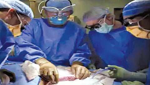 ब्रेन डेड व्यक्तीच्या शरीरात डुकराच्या किडनीचे प्रत्यारोपण