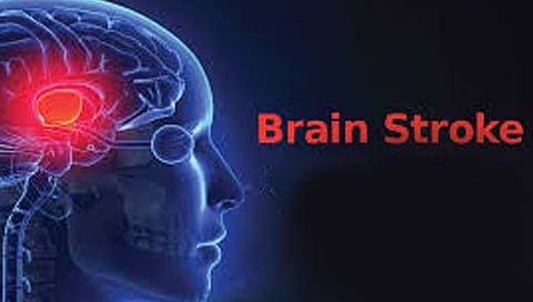 केईएम रुग्णालय : एक ते दीड तासातच ब्रेन स्ट्रोकचे निदान