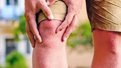 संधिवात : बदलती जीवनशैलीच संधिवाताला कारणीभूत