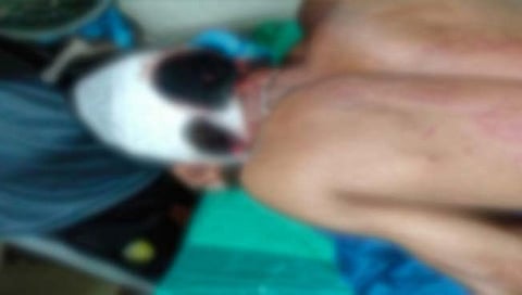 मुंबई : मित्राला सोडायला आलेल्या तरूणावर बिबट्याचा हल्ला