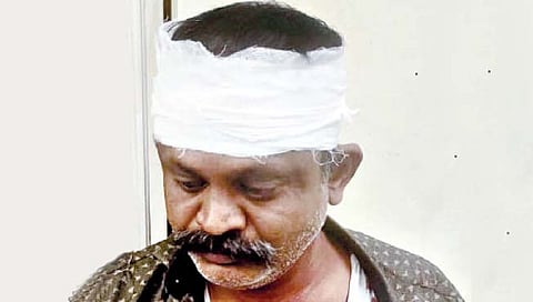 ST employees strike : वाहतूक नियंत्रकाला दगडाने मारहाण