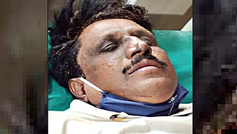 नाशिकच्या चर्चमध्ये फादरने जाळून घेतले