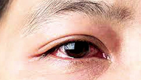 डोळ्यांची अनमोल दृष्टी वाचवता येऊ शकते