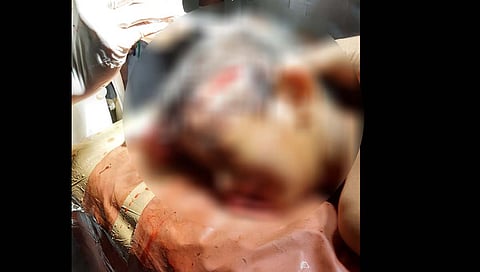 dombivali crime : वरप गावात अल्पवयीन मुलावर खूनी हल्ला