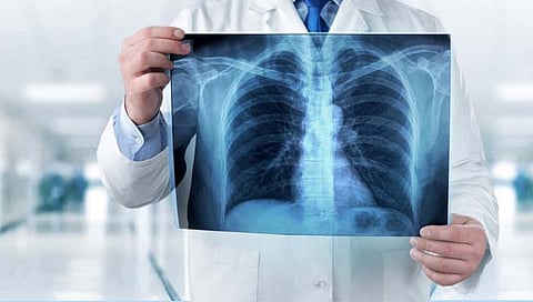 x-ray : आता एक्स रेच्या माध्यमातून होणार कोरोना चाचणी