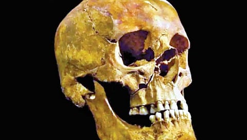 पाच हजार वर्षांपूर्वीची कानाची शस्त्रक्रिया