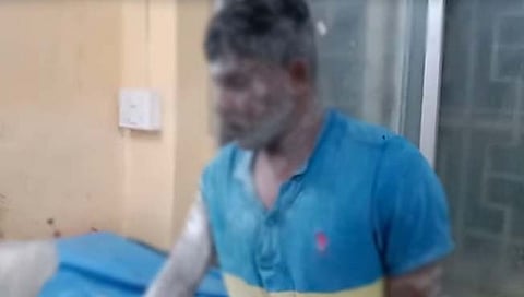 साताऱ्यात मुलाला बेदम मारहाण, उकळत्या चुन्यात दिले ढकलून