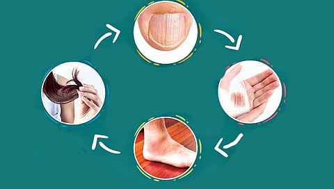 प्रोटिन्सच्या कमतरतेमुळे ‘ही’ होते हानी