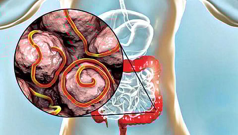 कृमी समस्येचा त्रास