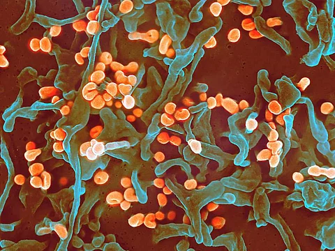कोरोना नंतर आता Lassa Fever चं संकट, तिघांना लागण, एकाचा मृत्यू