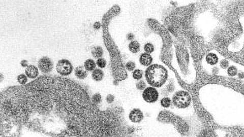 Lassa fever : लासा फिव्हरनं नवजात बालकाचा मृत्यू, हॉस्पिटलमधील कर्मचाऱ्यांना आयसोलेट होण्याचा सल्ला!
