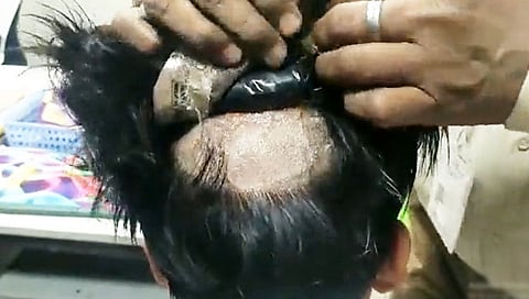 Watch Video : चक्क विगमध्ये लपवलं ३३ लाखांचं सोनं, प्रवाशाला अटक