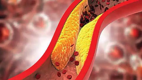 वैज्ञानिकांनी शोधला कोलेस्टेरॉल हटवण्याचा सहजसोपा उपाय