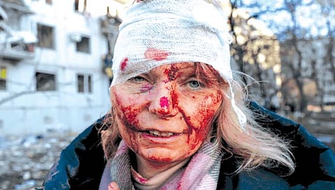 Russia-Ukraine conflict : महिलांचे महायुद्ध जगण्याशीच