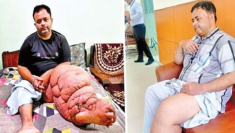 काय… ९० तासांत १८ शस्त्रक्रिया