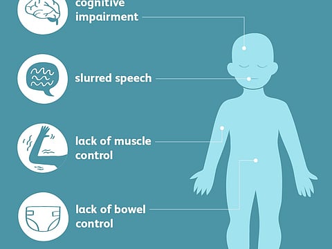 मायक्रोसॉफ्टचे सीईओ सत्या नडेला यांच्या मुलाचे सेरेब्रल पाल्सीमुळे निधन, जाणून घ्या काय आहे हा आजार