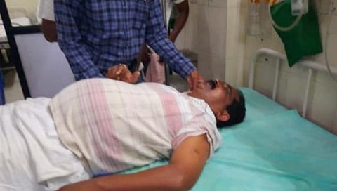 chandrapur : attack on Corporator