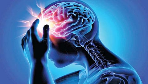 डोकेदुखी