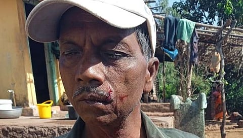 शेतात वैरण आणण्यासाठी गेलेल्या शेतकऱ्यांवर बिबट्याचा हल्ला