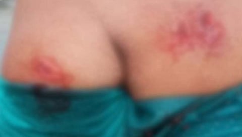 पुणे : मॉर्निंग वॉकला जाणाऱ्या महिलेवर बिबट्याचा हल्ला