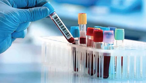 हार्ट अॅटॅक येण्यापूर्वी चार वर्षे आधीच होईल निदान, तंत्रज्ञान विकसित