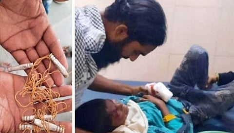 परभणी : जिलेटीनच्या कांड्या मोबाईलच्या बॅटरीला लावल्याने स्फोट : दोन मुले जखमी