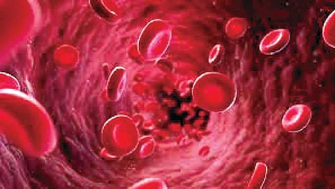 देशातील १० रुग्णालयांत थॅलेसेमियाचे उपचार, सरकारकडून १० लाखांपर्यंतची मदत