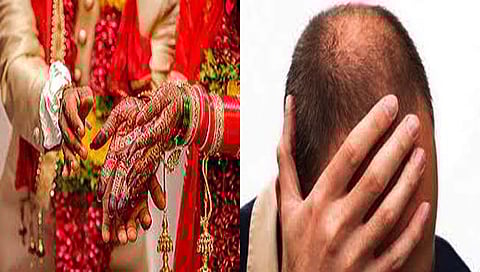 ‘विग’खाली टक्कल लपवणे नवरदेवाला पडले महागात, खावी लागली नवरीची लाथ!