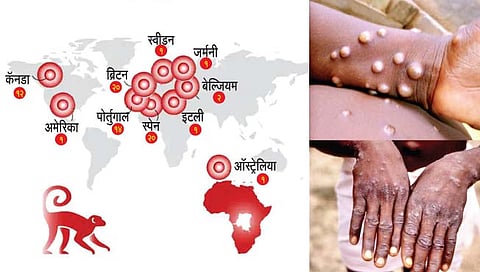 MonkeyPox चा कम्युनिटी स्प्रेड! युरोपसह २० देशांत रुग्णसंख्येत वाढ, WHO नं दिला इशारा