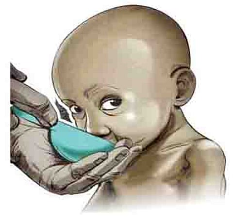 पुणे जिल्ह्यात 220 कुपोषित बालके