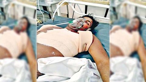 जखमी मंडलिक काळे