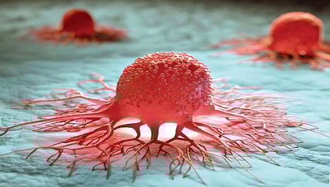 कर्करोग