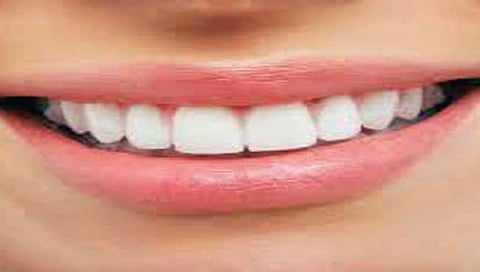 ‘तिने’ स्वतःच काढले आपले तेरा दात!