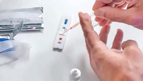 रोगप्रतिकारकशक्ती