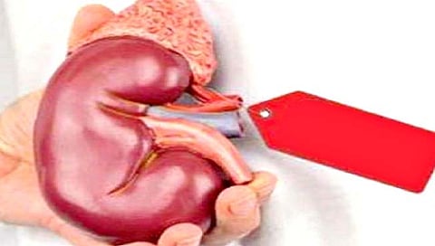 गरजू ठरतात किडनीदानाचे शिकार; दिल्लीतील दलालांची टोळी कार्यरत