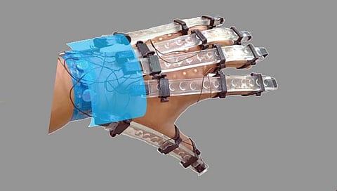 स्ट्रोक पीडितांसाठी थ्री-डी प्रिंटेड हातमोजे