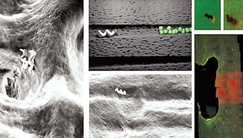 नॅनो रोबो करणार दंत उपचारांना मदत