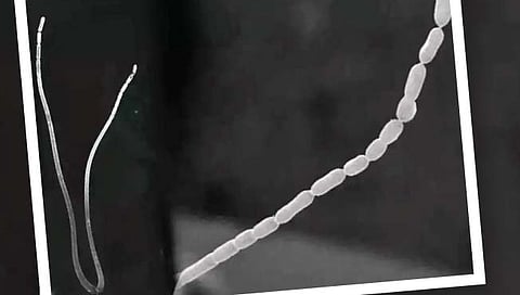 जगातील सर्वात मोठा जीवाणू!