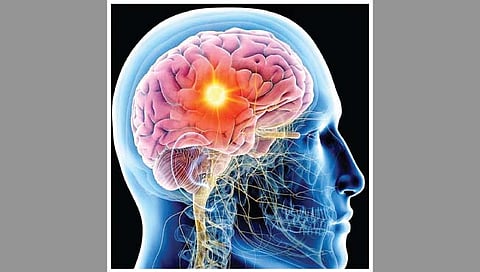 अपस्माराचा मुकाबला