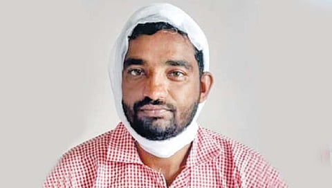 कोरेगाव : निवडणूक निकालाच्या रागातून भोसे उपसरपंचावर हल्ला