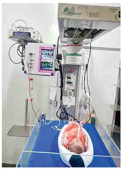 स्मार्ट बेबी वॉर्मर.