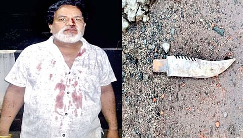 जखमी जगदीश डंबे. सर्या छायाचित्रात हल्ल्यात वापरण्यात आलेला सुरा.