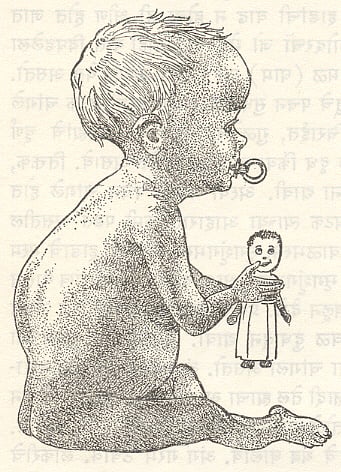 लॉकडाउननंतर यंदा मुडदूसचे रुग्ण वाढले