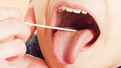 आरोग्य : समस्या टॉन्सिल्सची