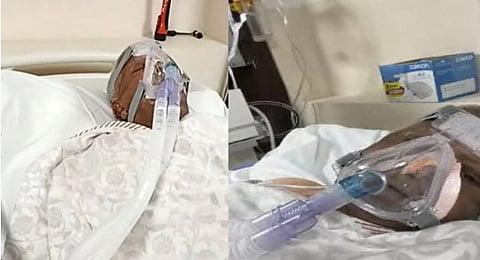 लालू प्रसाद यादव यांची प्रकृती गंभीर, आज एअर ॲम्ब्युलन्सनं दिल्लीला हलविणार