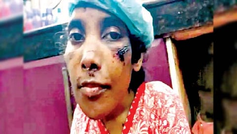 धक्कादायक! दिव्यांग मुलीला आठ वर्षे घरात डांबले, जिभेने फरशी साफ करायला लावली, दातही तोडले