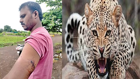 नाशिक : मध्यरात्री अंगणात झोपलेल्या युवकावर बिबट्याचा हल्ला, हिमतीने वाचविला जीव…