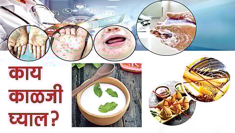 ‘हँड-फुट-माउथ’ संसर्ग