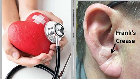 कानही देतात हार्ट अॅटॅकचे संकेत!