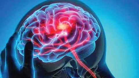 कोरोनानंतर चेतासंस्थेच्या आजारांचा धोका अधिक